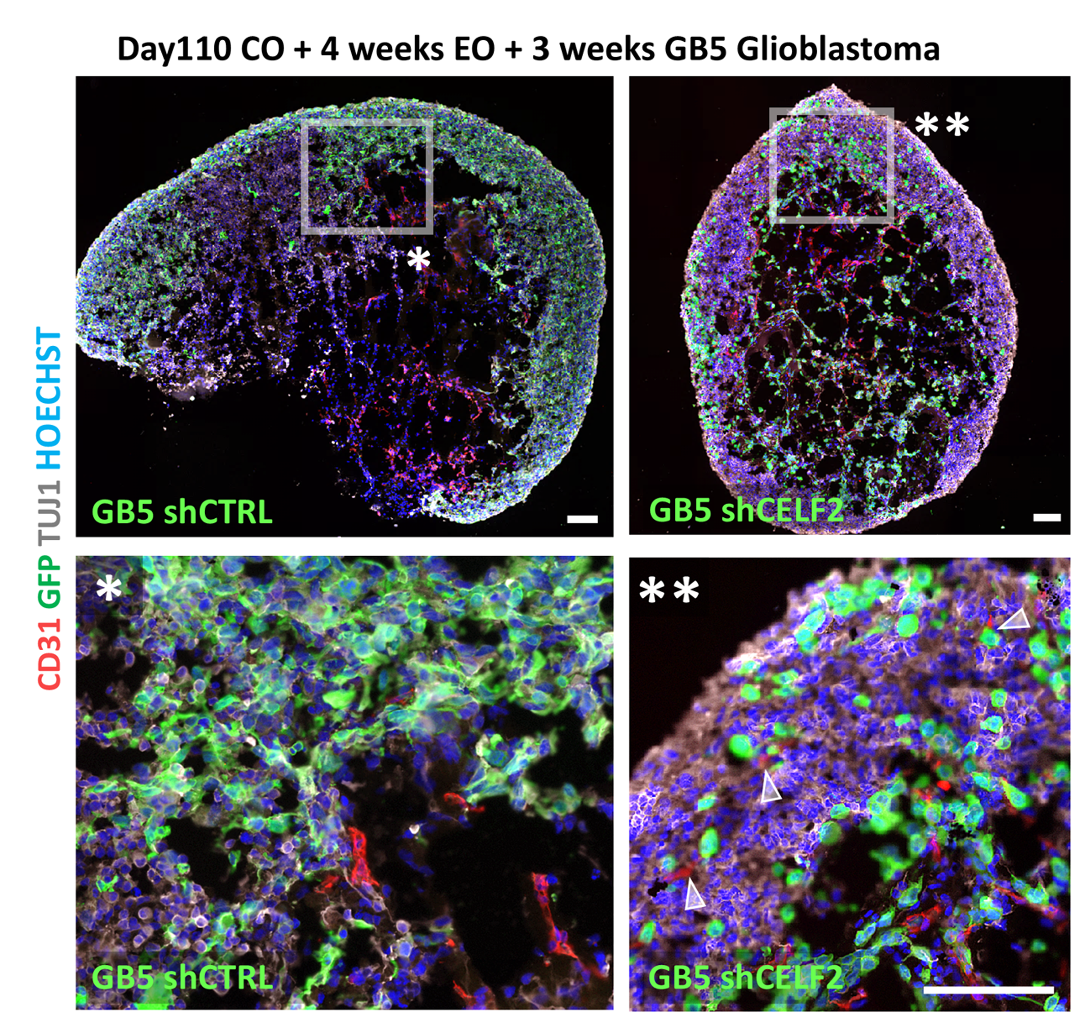 Bertacchi, Ladoux et al, 2026, Cell Death and Disease.